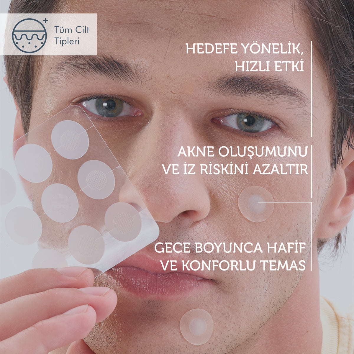Microneedle Acne Patch with Technology, Anti-Pimple Patch, Microneedle Acne Tape, 9 Pieces