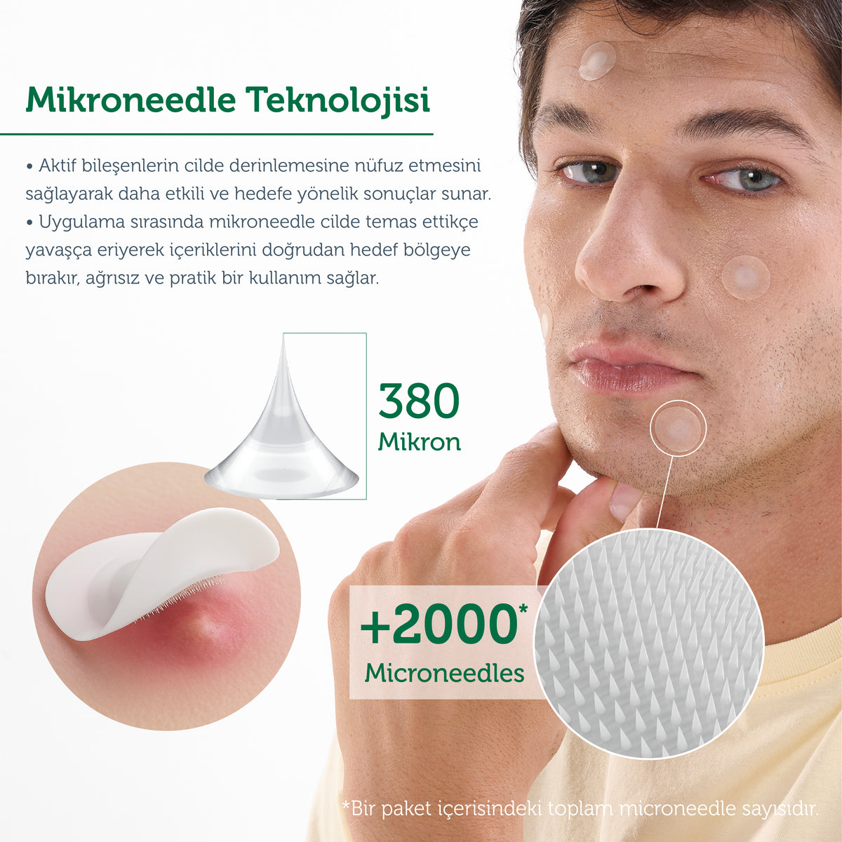 Microneedle Acne Patch with Technology, Anti-Pimple Patch, Microneedle Acne Tape, 9 Pieces