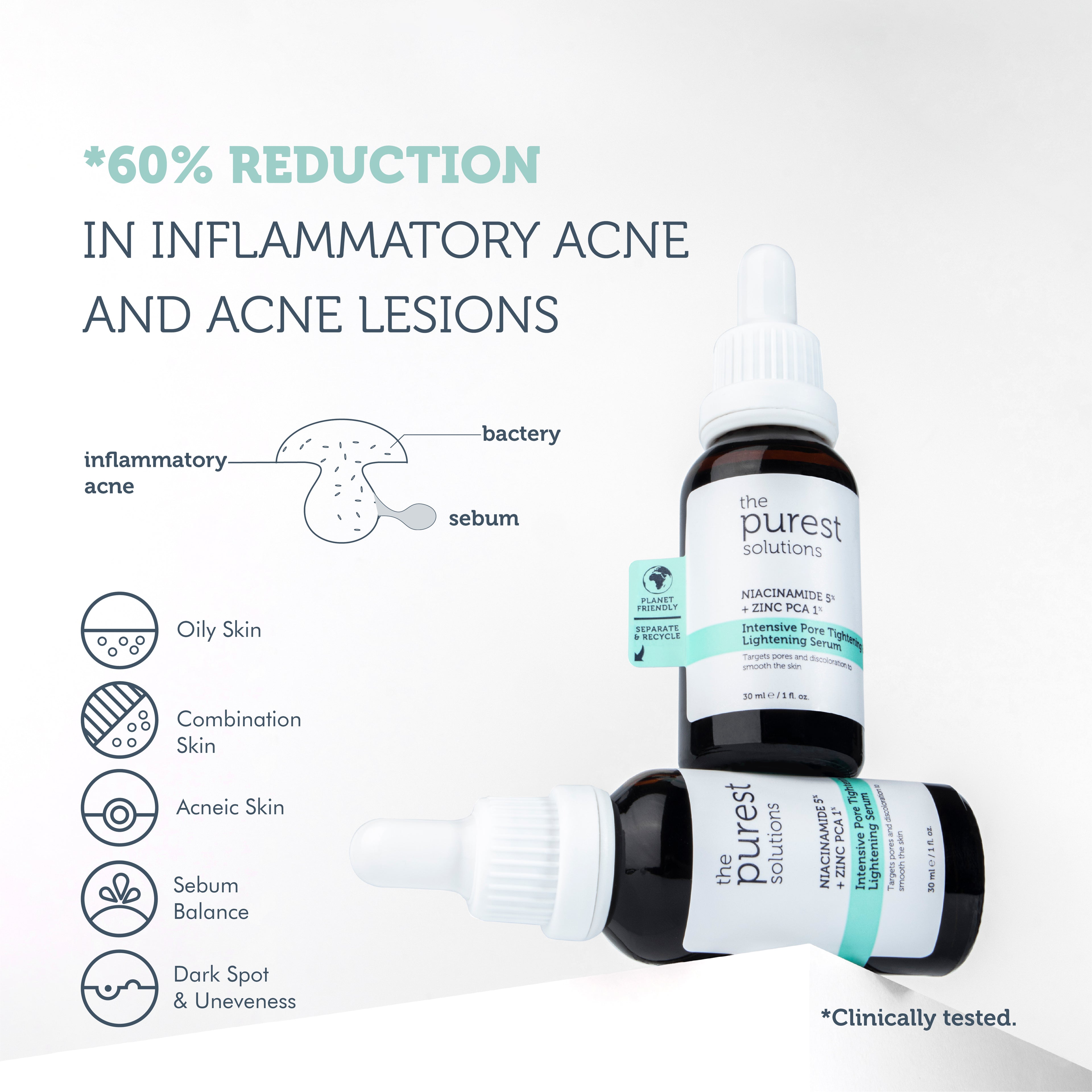 Anti-Blackhead, Pore and Acne Care Niacinamide Serum 30 Ml