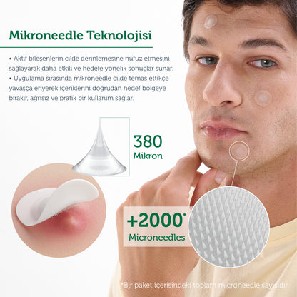 Microneedle Acne Patch with Technology, Anti-Pimple Patch, Microneedle Acne Tape, 9 Pieces